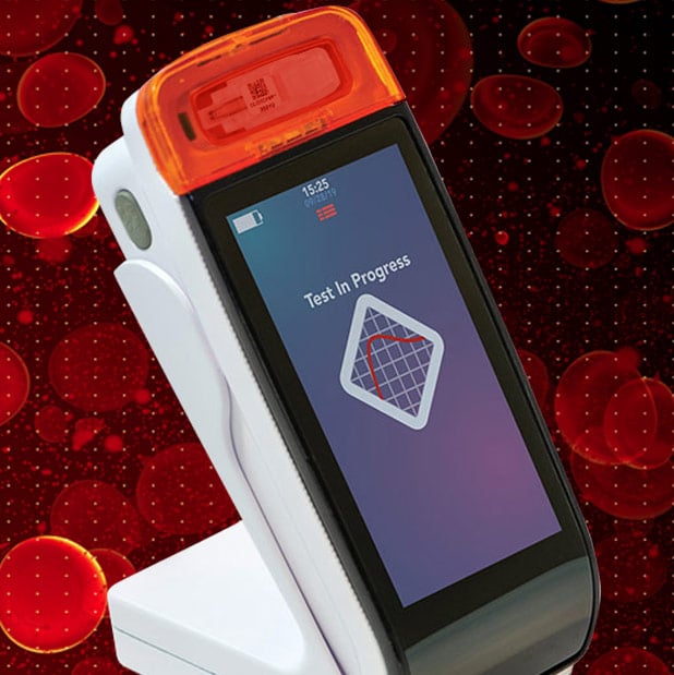 ClotChip Medical Diagnostic Device - Case Study