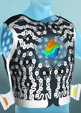 The ECVue cardiac mapping vest improves the patient experience