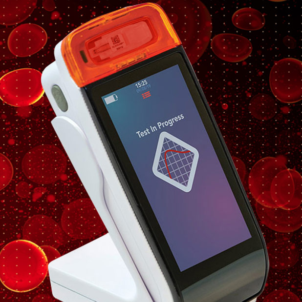 ClotChip Point-of-Care Blood Clotting Diagnostic Device