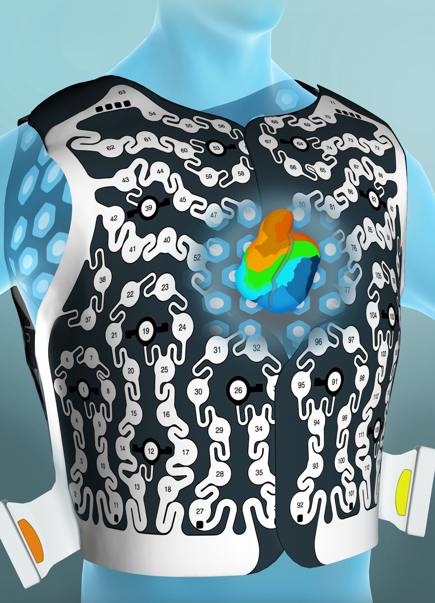 cardioinsight_ecvue-vest-cardiac-mapping